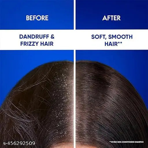 HEAD & SHOULDERS 2 in 1  Anti-Dandruff Shampoo + Conditioner With Almond Milk Anti-Hairfall  650 ml Head & Shoulder